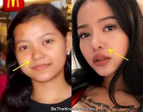 bella poarch before surgery|Bella Poarch Plastic Surgery: Did She Get Her Nose。